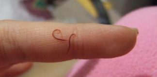 Trattamento dei pesci affetti da Camallanus e altri Nematodi Camallanus cotti