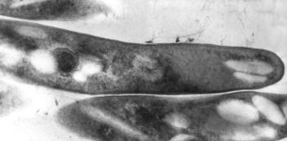 Micobatteriosi nei pesci d’acquario Mycobacterium tuberculosis